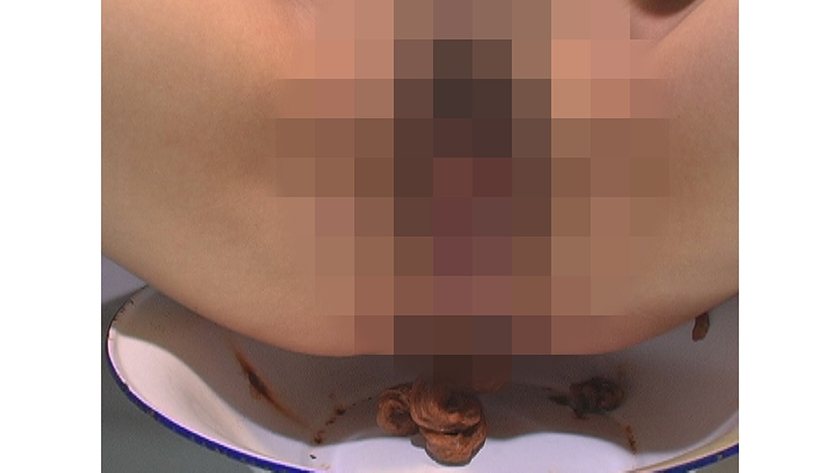 美肌活性腸内還元エステ うんこ塗りたくり発酵美容法 画像8